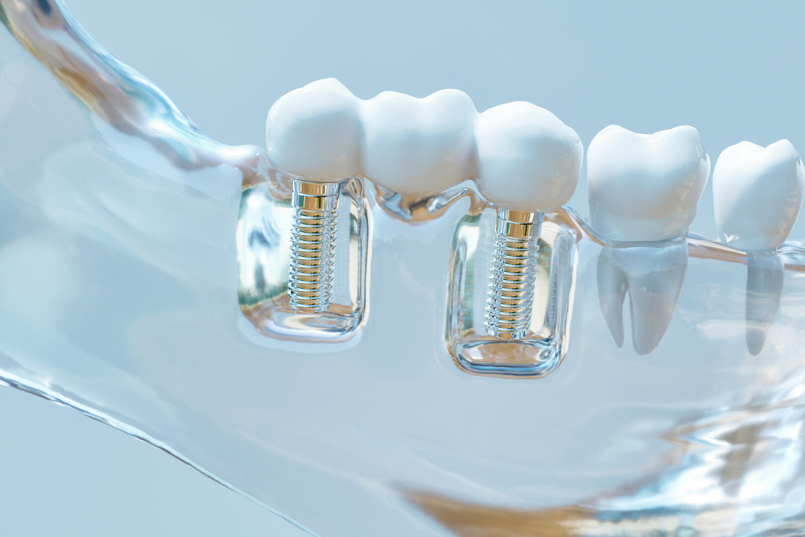 Tooth human implant 3D Rendering